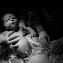 Bevallingsverhaal: “De rand van mijn baarmoeder zat vol met vocht”