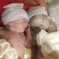 Bevallingsverhaal: “Ik riep dat ik mijn tweede meisje al direct in het geboortekanaal voelde zakken”