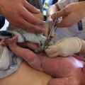 Bevallingsverhaal: “Elin werd 3 weken te vroeg geboren in het ziekenhuis in Zweden!“