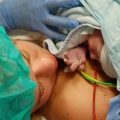 Geboorteverhaal: “Liv zat vast in het geboortekanaal”