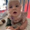 Baby Aimée overleefde een hersenvliesontsteking