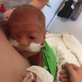 Maykel werd met 31 weken geboren en ging in de eerste dagen stapjes vooruit