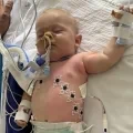Baby Loran kreeg een hartoperatie: “Niemand had mij gezegd dat het herstel zo heftig zou zijn”