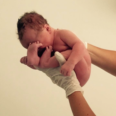 Verloskundige Leonie vertelt over haar allereerste bevalling waarbij het armpje van de baby vastzat