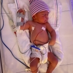 De spierspanning van mijn baby is zo hoog, dat het soms gevaarlijk is