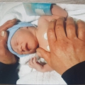 De groei van mijn baby bleef flink achter vanaf 20 weken zwangerschap